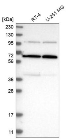 R3HCC1 Antibody, Novus Biologicals 25 &mu;L; Unlabeled:Antibodies, Polyclonal